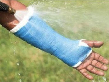 Waterproof Cast - Short Arm Padding Kit - AquaCast
